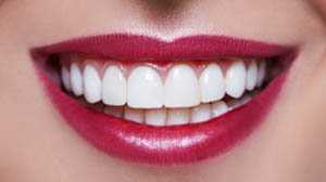 dịch vu trồng răng sứ tại phòng khám răng hàm mặt uy tín Ngọc Anh