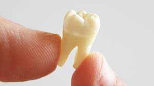 dịch vu nhổ răng tại phòng khám nha khoa răng hàm mặt Ngọc Anh