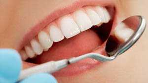 dịch vu trám răng tại phòng khám nha khoa răng hàm mặt Ngọc Anh